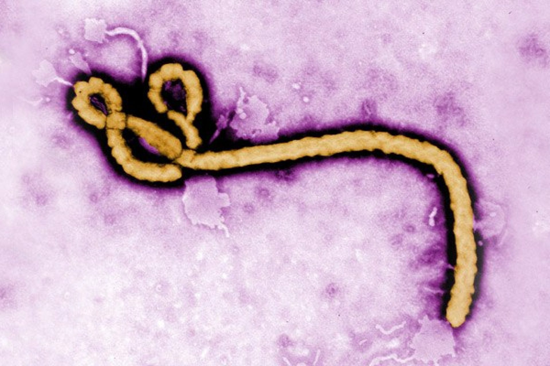 ebola_virus_3