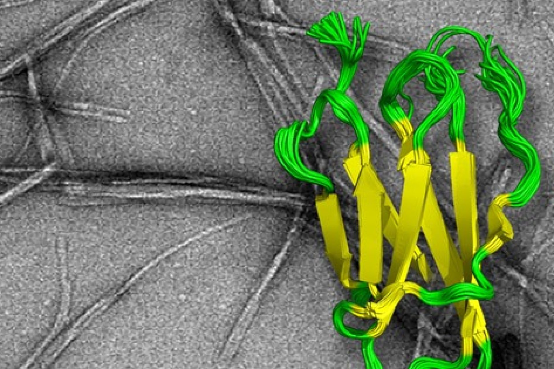 electron_microscope_image_2